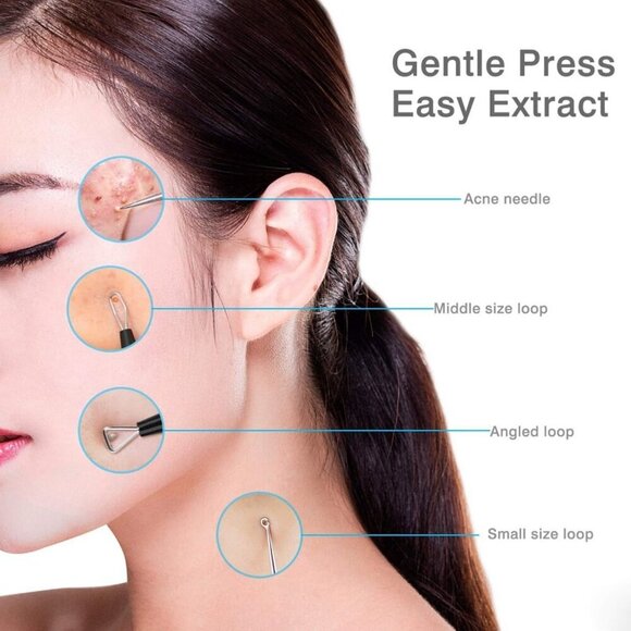 Blackhead Remover Tool Comedones Extractor Acne Removal Kit for Blemish, Whitehe - Picture 5 of 5